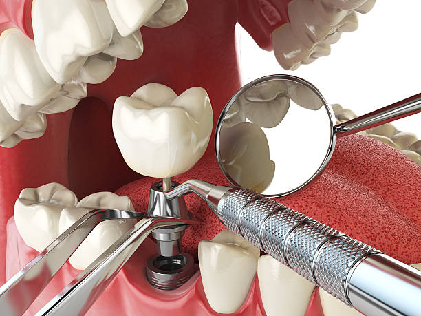 Reliable NH Emergency Dentist Solutions